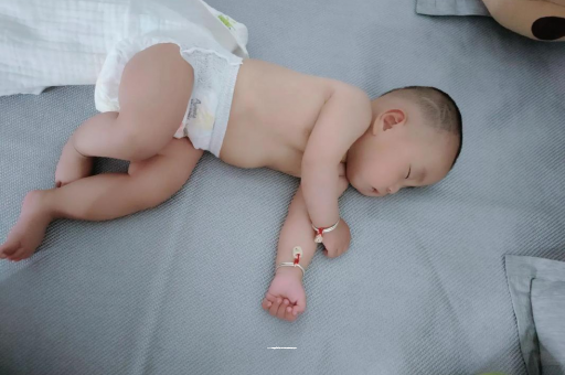 乐清宝宝头上长痱子